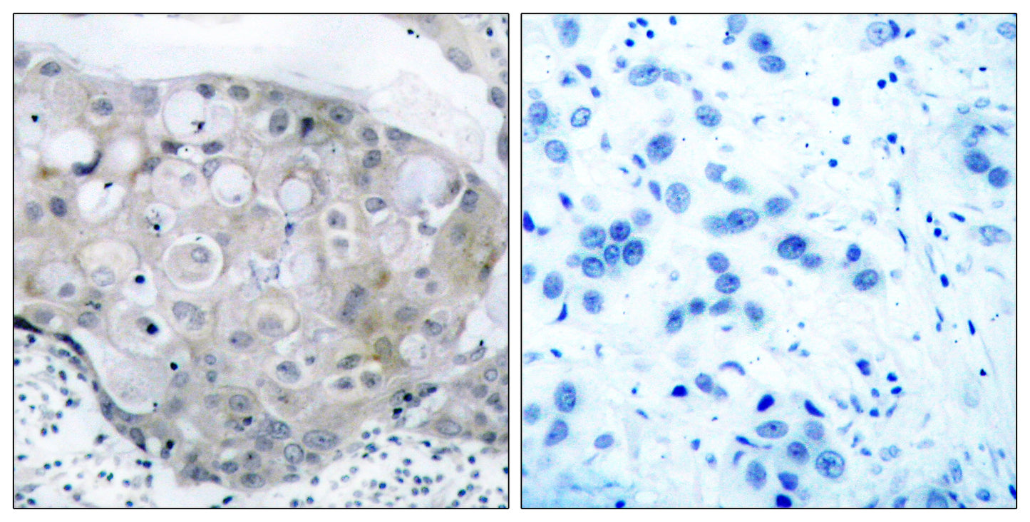 Flk-1 (phospho Tyr951) Rabbit Polyclonal Antibody