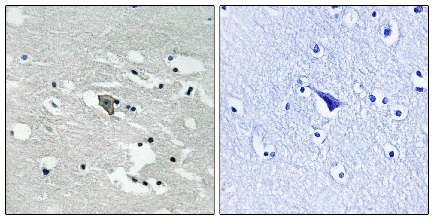 Flt-1 (phospho Tyr1048) Rabbit Polyclonal Antibody