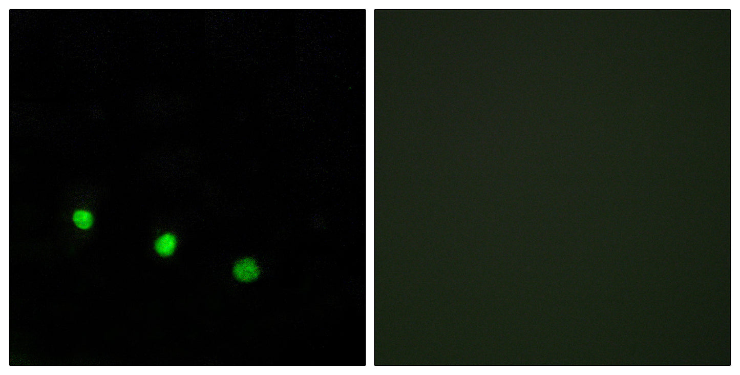 Fos B (phospho Ser27) Rabbit Polyclonal Antibody
