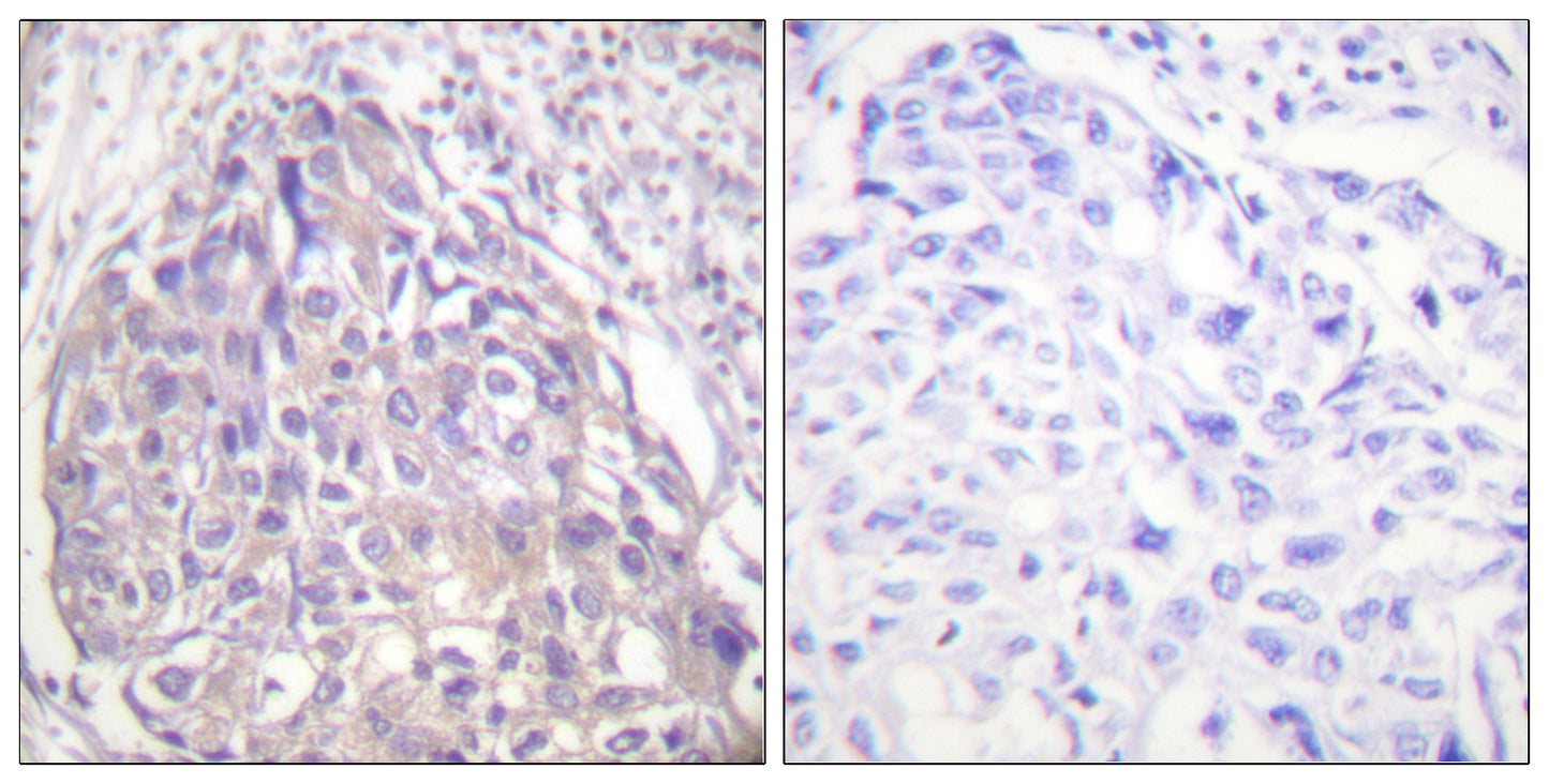 FoxO1/3/4 (phospho Thr24/32) Rabbit Polyclonal Antibody