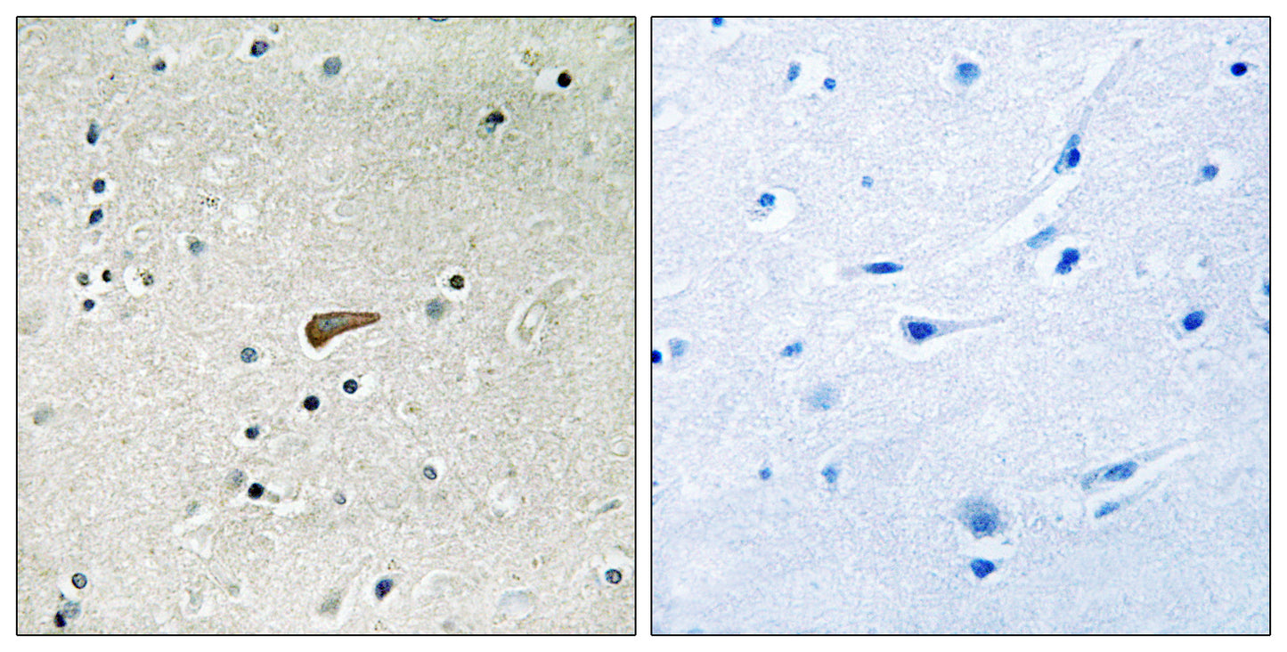 FRS2 (phospho Tyr436) Rabbit Polyclonal Antibody