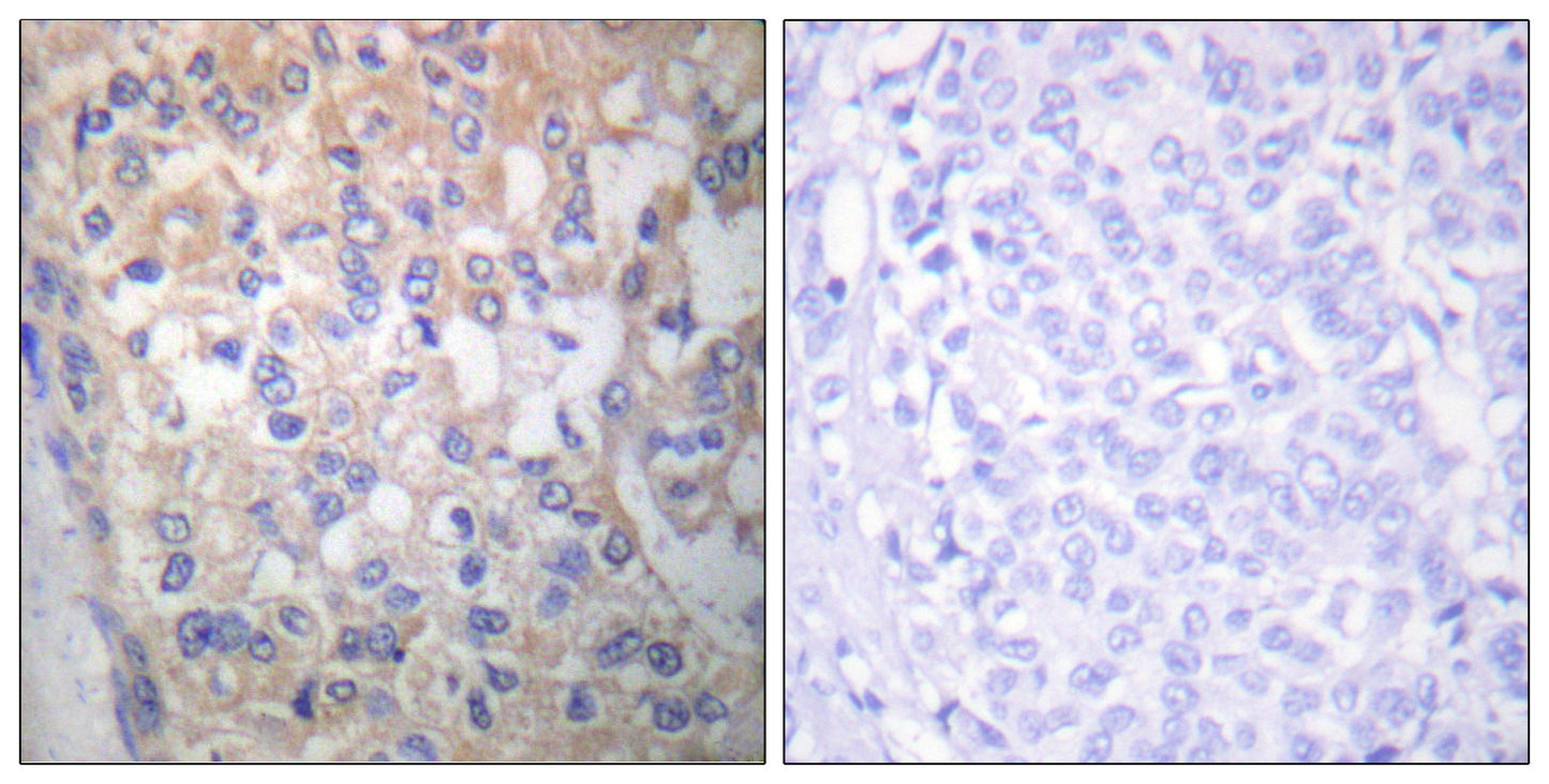 Fyn (phospho Tyr530) Rabbit Polyclonal Antibody