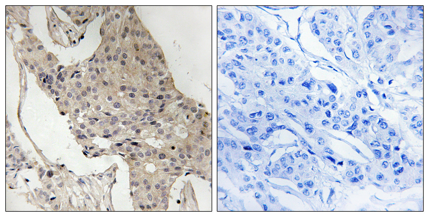Gab 2 (phospho Ser623) Rabbit Polyclonal Antibody