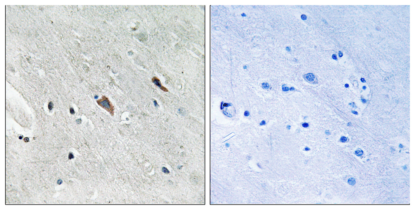 Gab 2 (phospho Tyr643) Rabbit Polyclonal Antibody