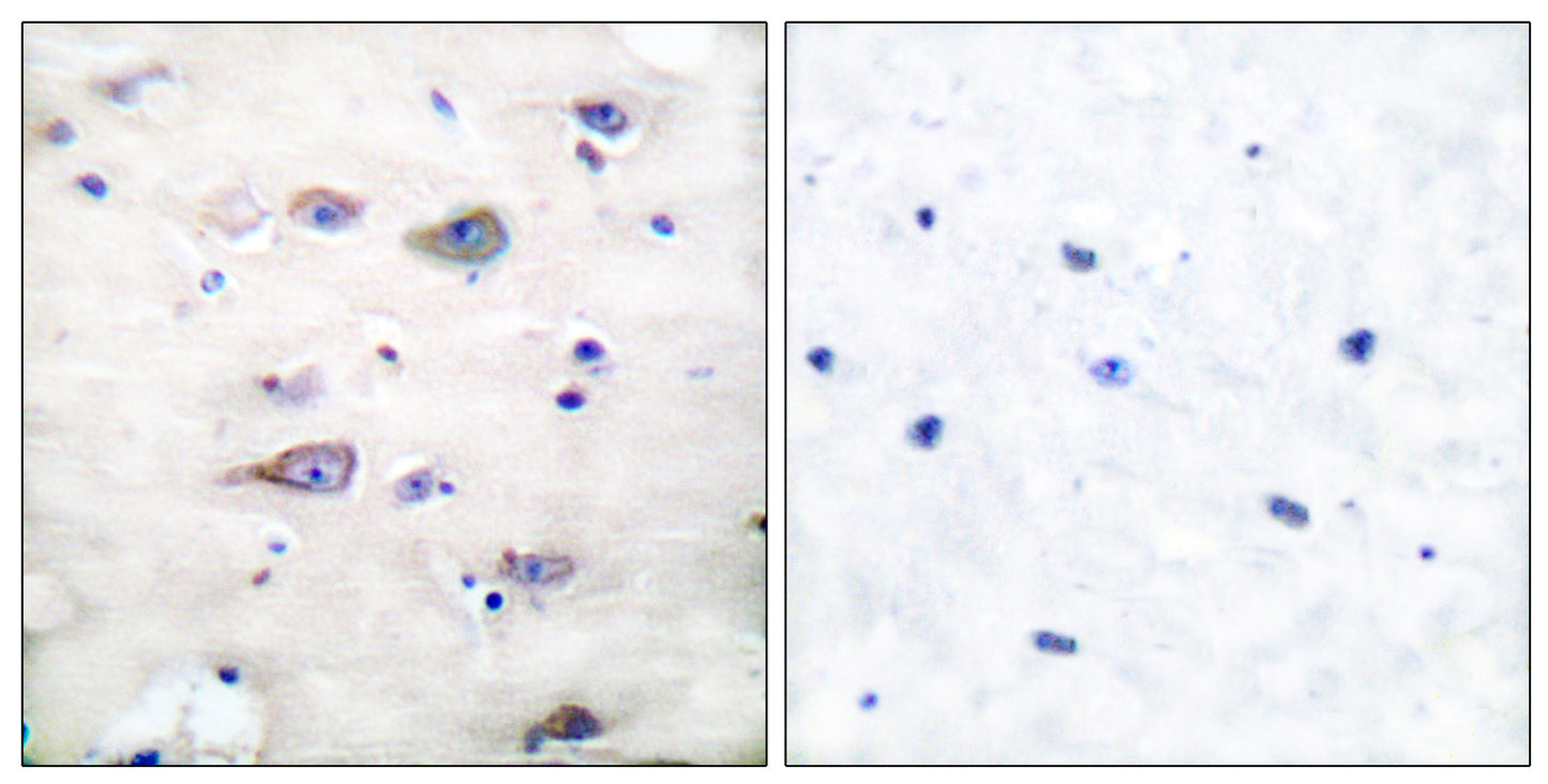 GluR-2 (phospho Ser880) Rabbit Polyclonal Antibody