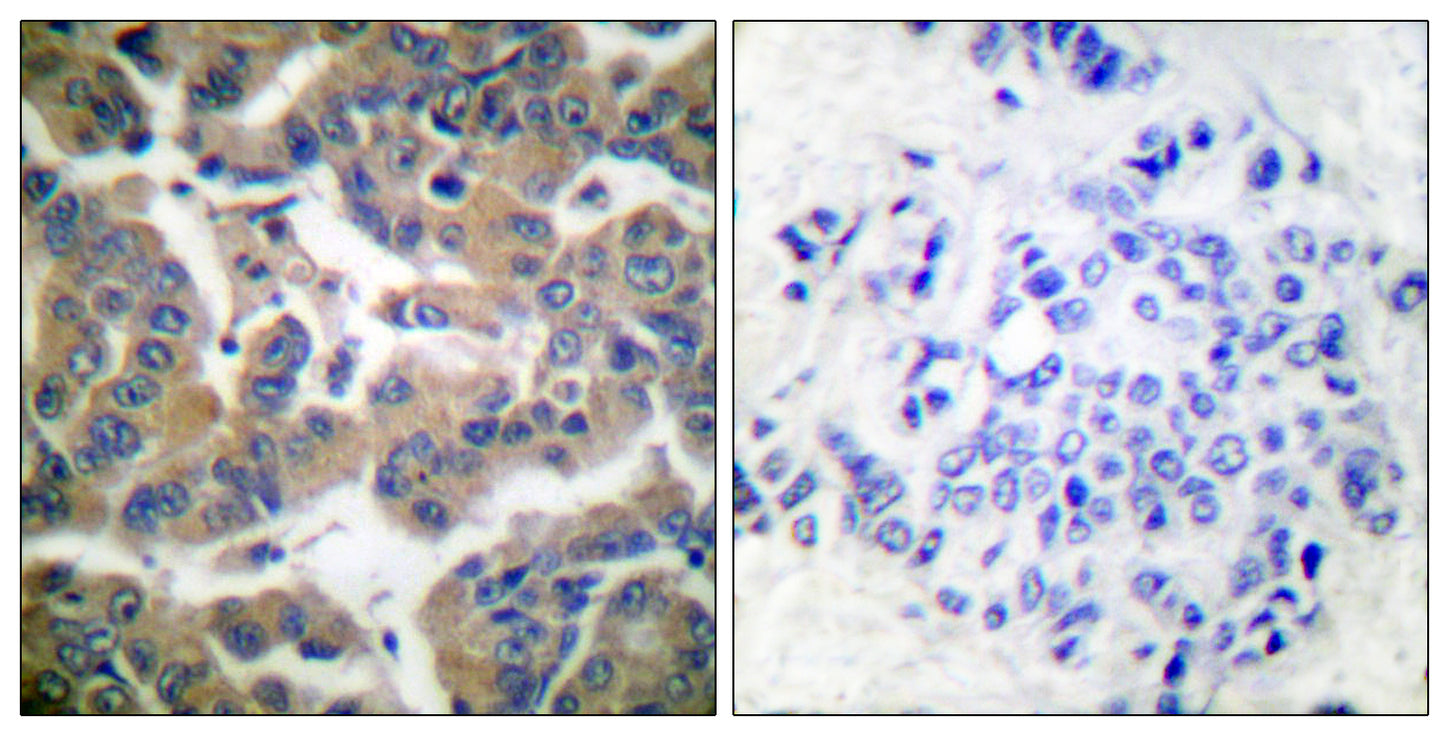 GR (phospho Ser211) Rabbit Polyclonal Antibody