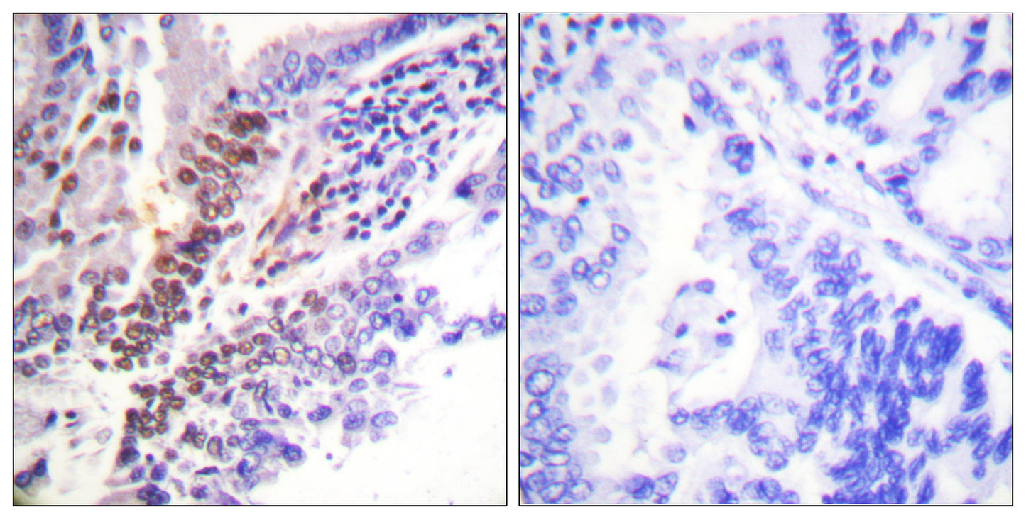 GR (phospho Ser226) Rabbit Polyclonal Antibody