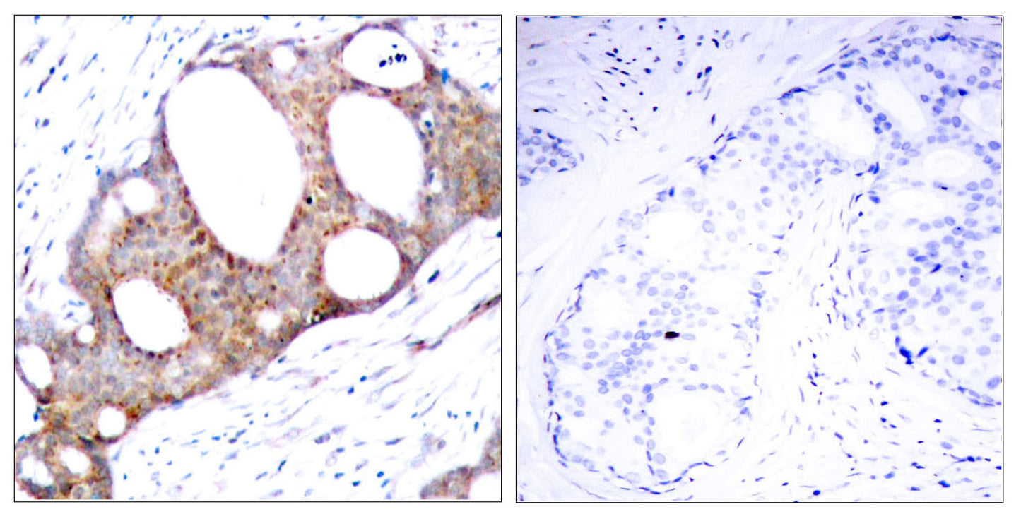 GSK3α (phospho Ser21) Rabbit Polyclonal Antibody
