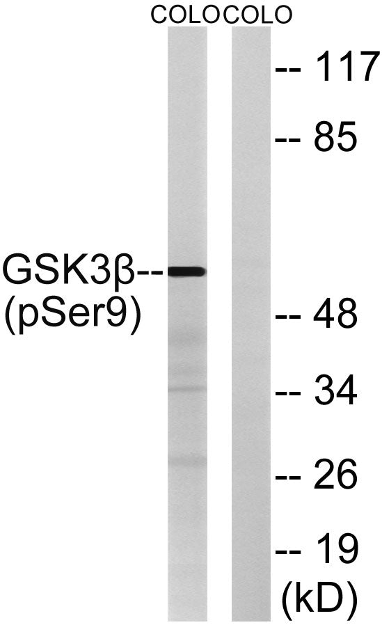 GSK3β (phospho Ser9) Rabbit Polyclonal Antibody