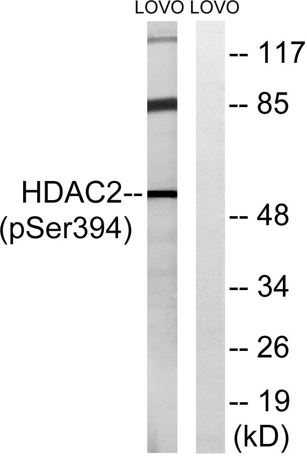 HDAC2 (phospho Ser394) Rabbit Polyclonal Antibody
