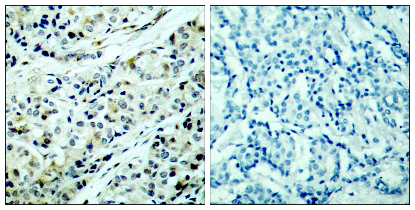 HDAC5 (phospho Ser498) Rabbit Polyclonal Antibody