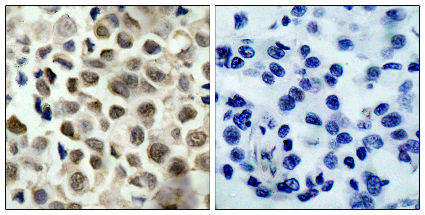 HDAC8 (phospho Ser39) Rabbit Polyclonal Antibody