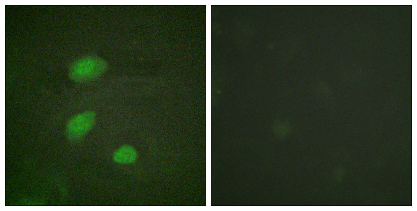 HIRA (phospho Thr555) Rabbit Polyclonal Antibody