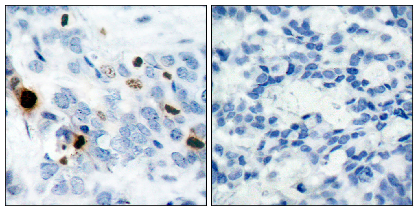 Histone H3 (phospho Ser10) Rabbit Polyclonal Antibody