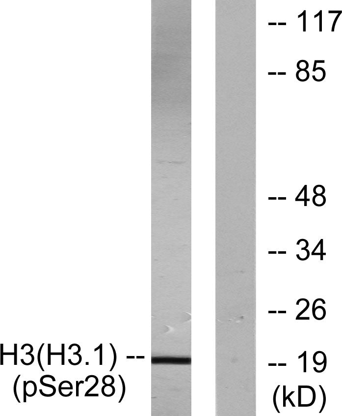 Histone H3 (phospho Ser28) Rabbit Polyclonal Antibody