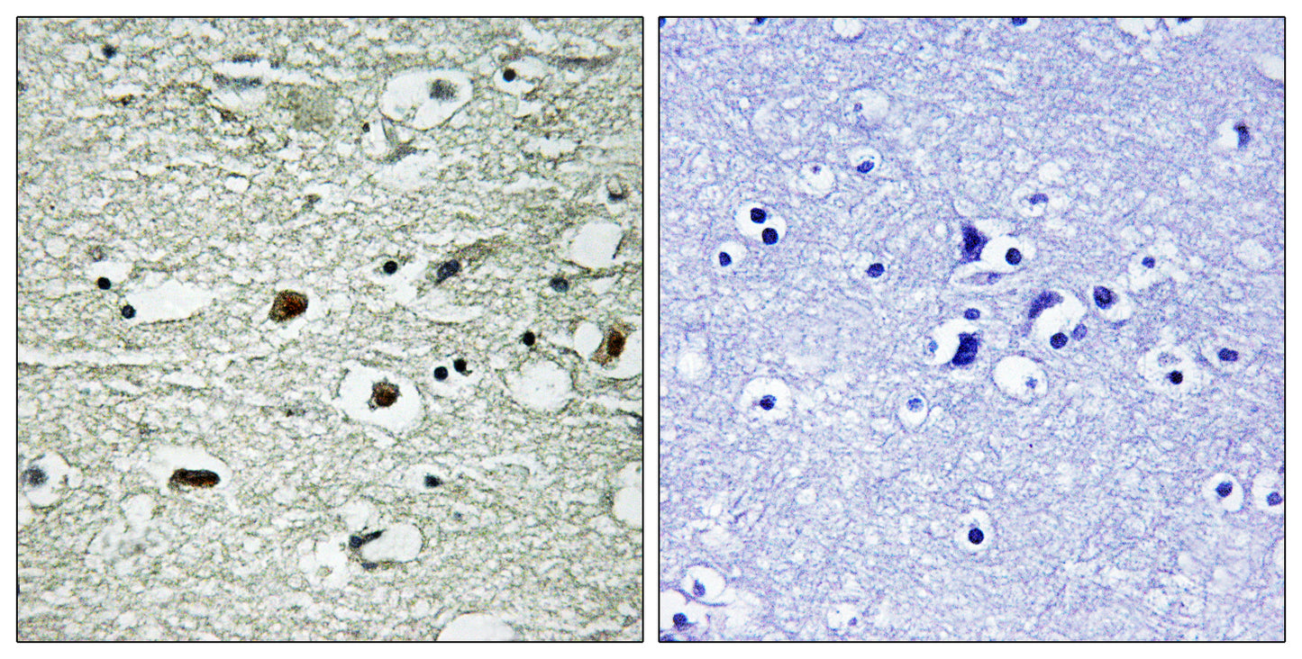 hnRNP C1/2 (phospho Ser260) Rabbit Polyclonal Antibody