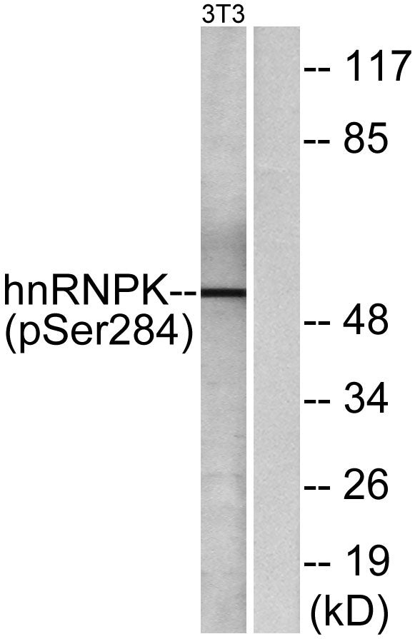 hnRNP K (phospho Ser284) Rabbit Polyclonal Antibody