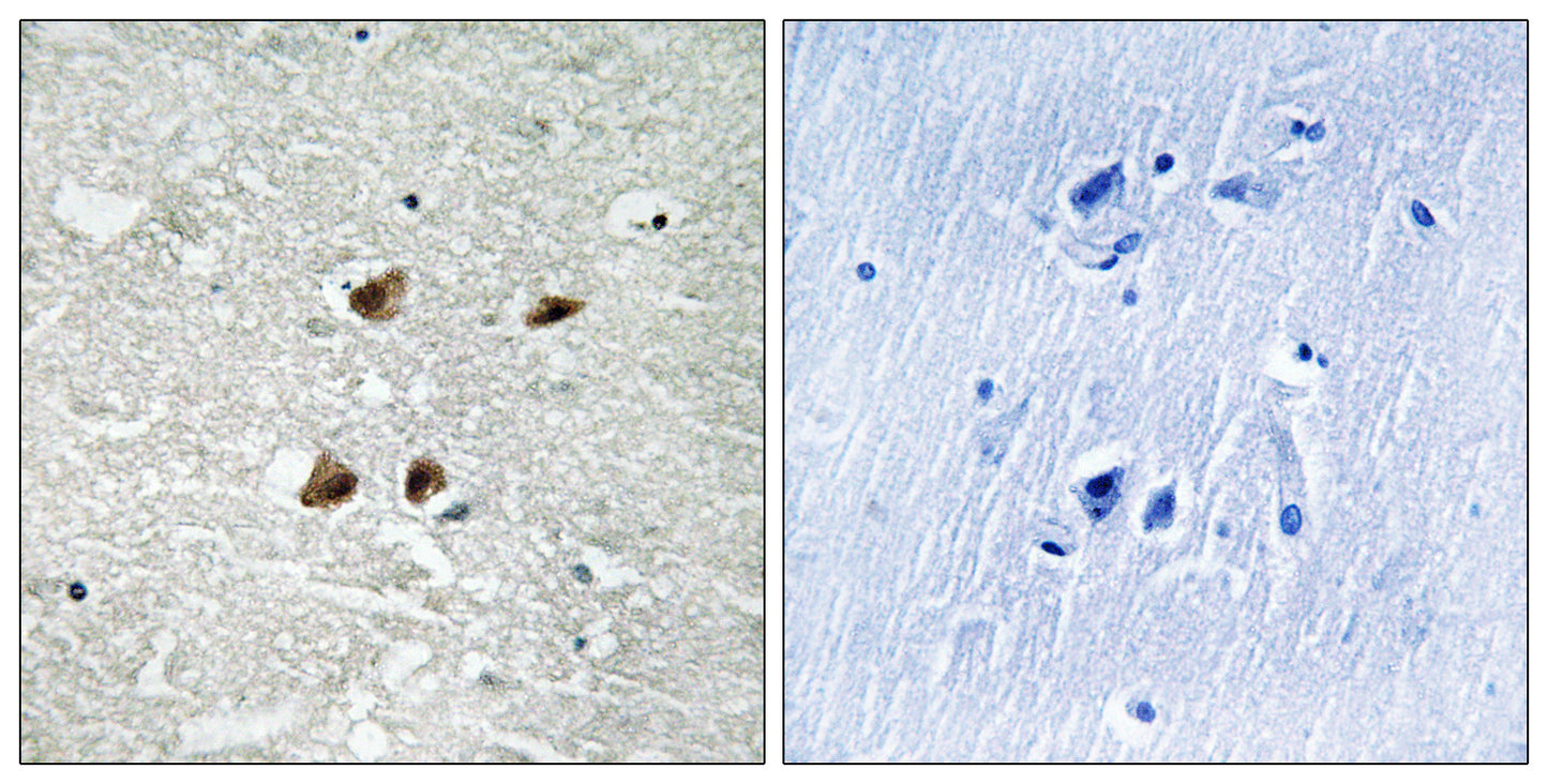 HSF1 (phospho Ser121) Rabbit Polyclonal Antibody
