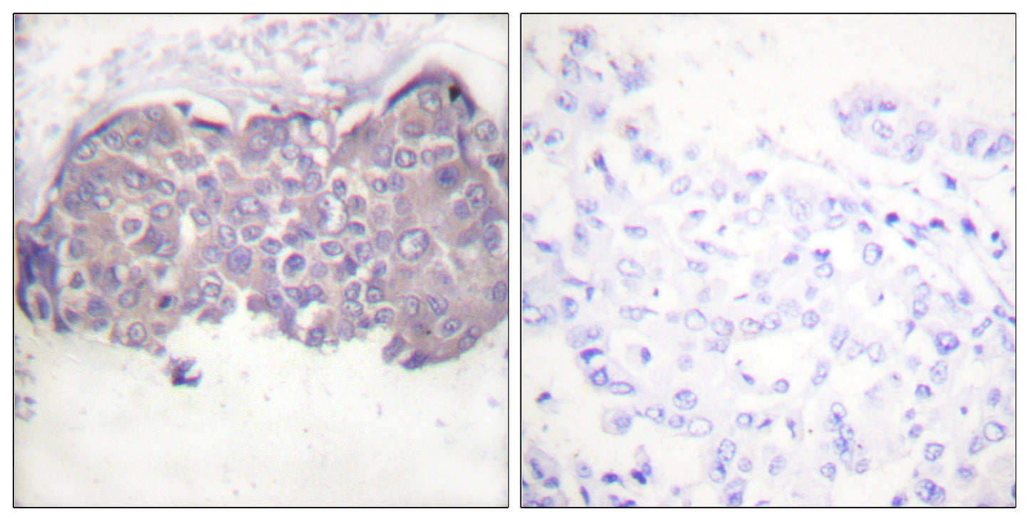 HSL (phospho Ser552) Rabbit Polyclonal Antibody