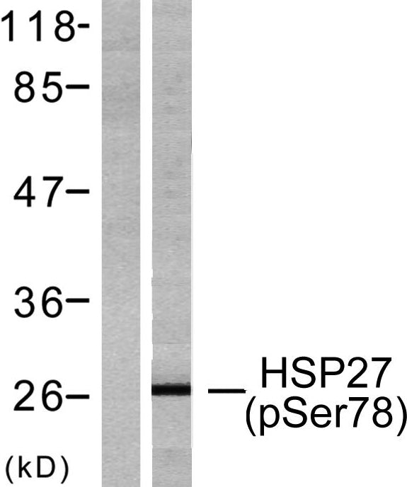 HSP27 (phospho Ser78) Rabbit Polyclonal Antibody