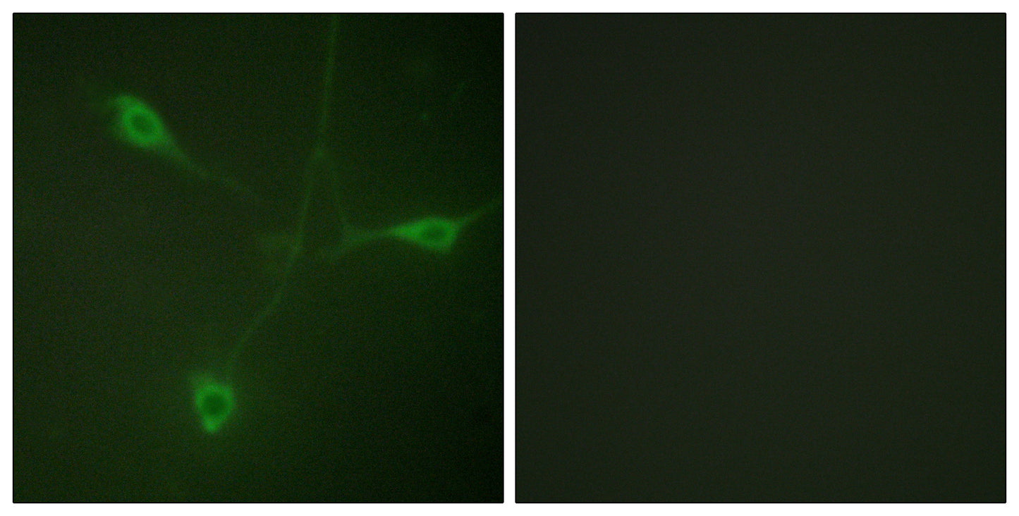 HSP90β (phospho Ser226) Rabbit Polyclonal Antibody
