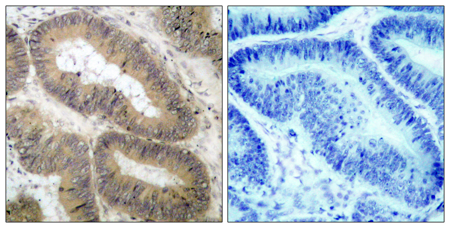 IKKα (phospho Thr23) Rabbit Polyclonal Antibody