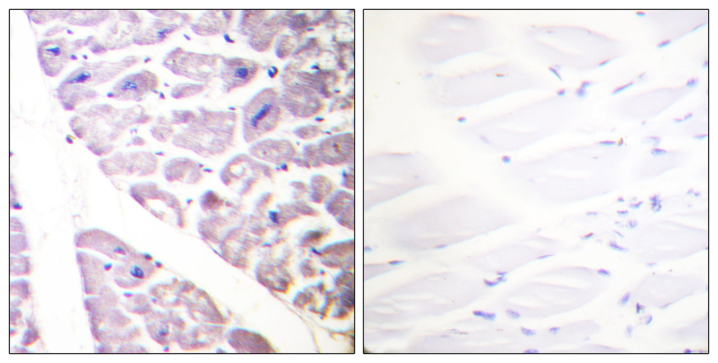 IKKα/β (phospho Ser176/177) Rabbit Polyclonal Antibody