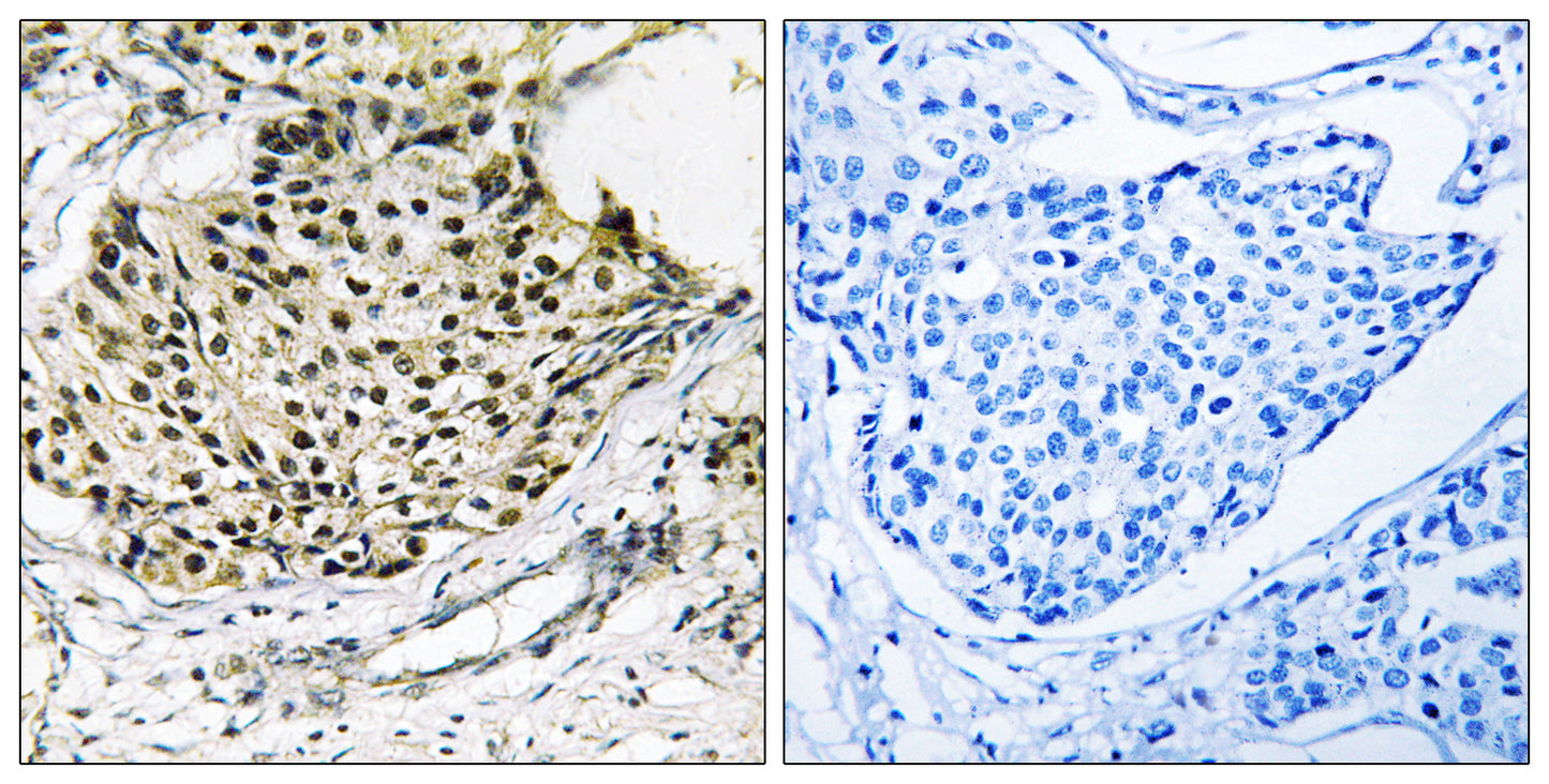IKKγ (phospho Ser31) Rabbit Polyclonal Antibody
