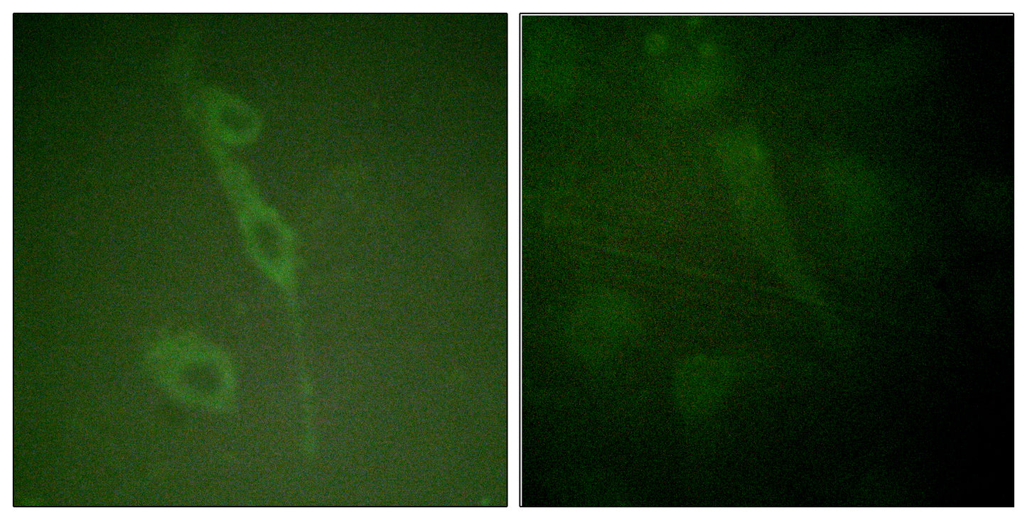 IL-7R (phospho Tyr449) Rabbit Polyclonal Antibody