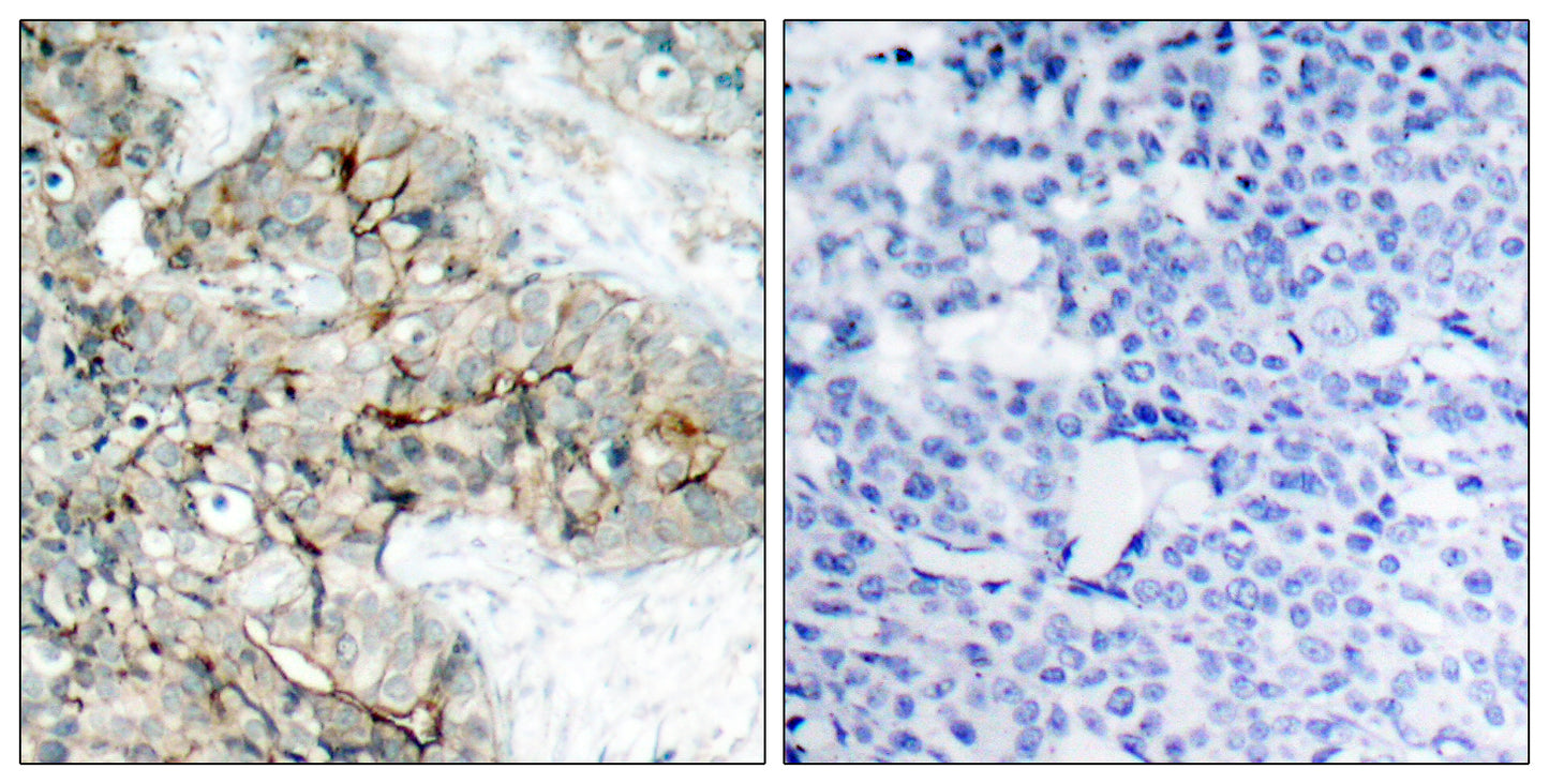 Integrin β3 (phospho Tyr773) Rabbit Polyclonal Antibody