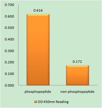 IP3R-I (phospho Ser1598) Rabbit Polyclonal Antibody