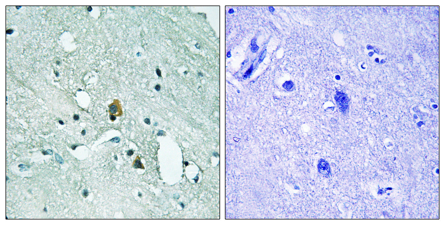 IP3R-I (phospho Ser1764) Rabbit Polyclonal Antibody