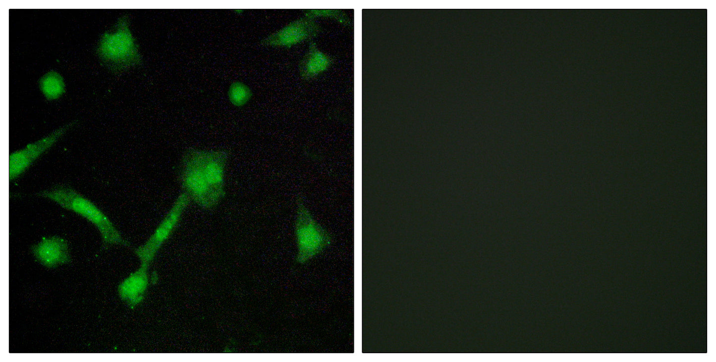 IκB-α (phospho Ser32/S36) Rabbit Polyclonal Antibody