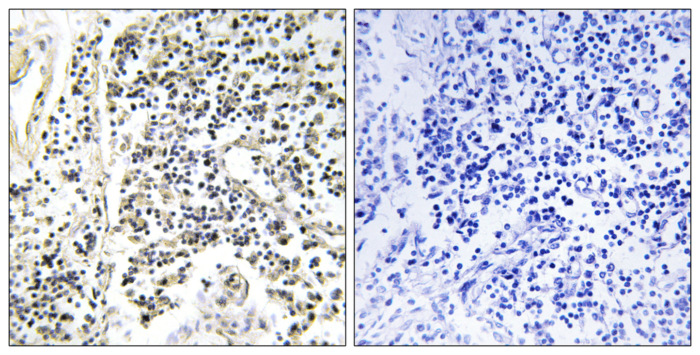 IκB-α (phospho Tyr305) Rabbit Polyclonal Antibody