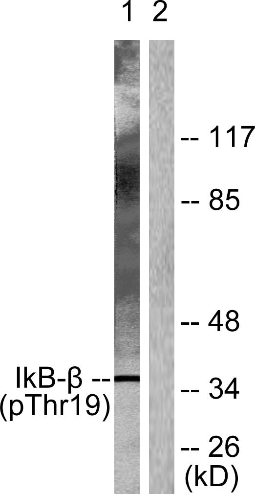 IκB-β (phospho Thr19) Rabbit Polyclonal Antibody