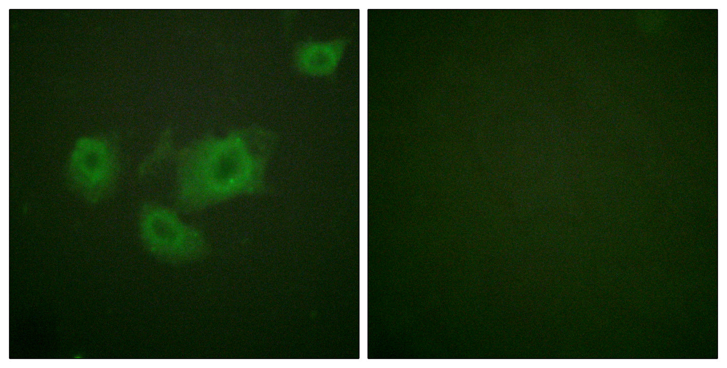 KIR6.2 (phospho Thr224) Rabbit Polyclonal Antibody