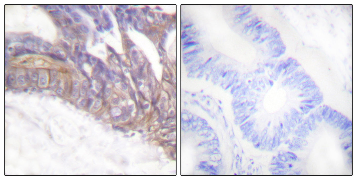 LAT (phospho Tyr191) Rabbit Polyclonal Antibody