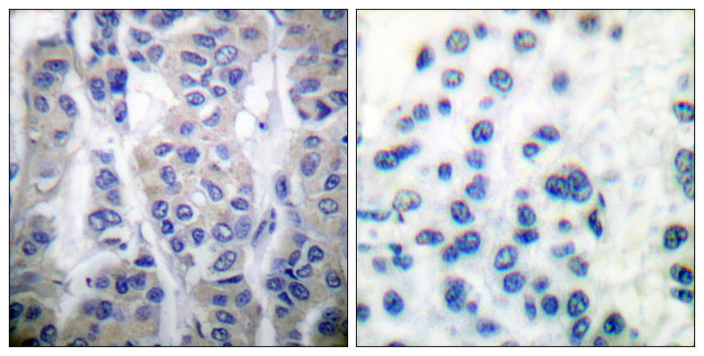 LIMK-1/2 (phospho Thr508/505) Rabbit Polyclonal Antibody