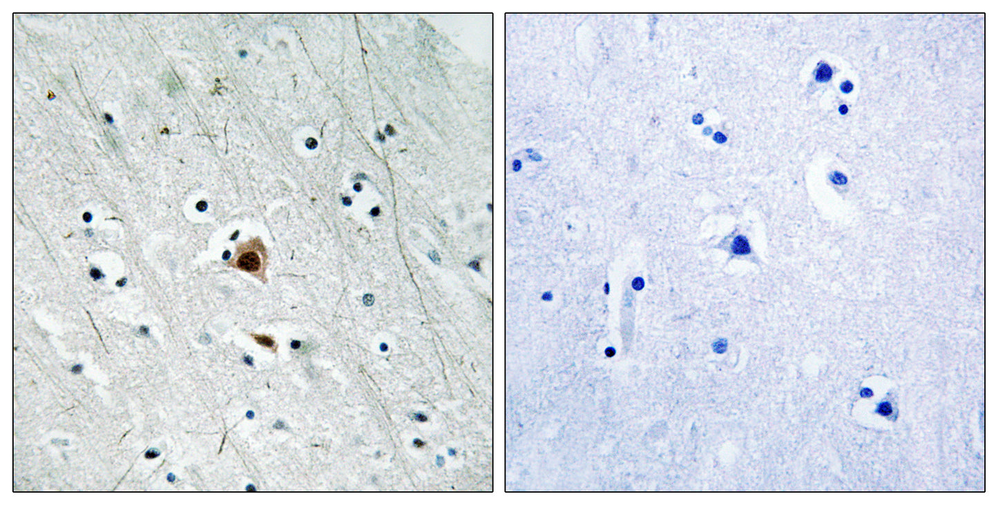 MAPKAPK-2 (phospho Ser272) Rabbit Polyclonal Antibody