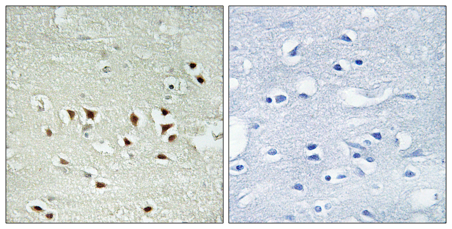 MAPKAPK-2 (phospho Thr334) Rabbit Polyclonal Antibody