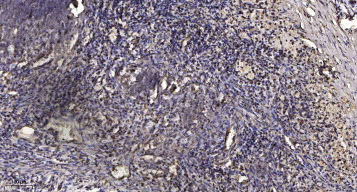 Mcl-1 (phospho-Thr163)  Rabbit Polyclonal Antibody
