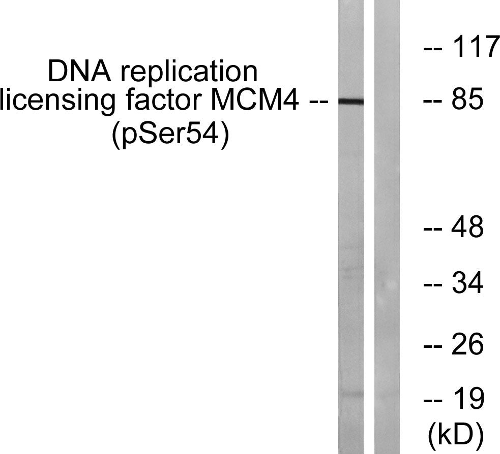 MCM4 (phospho Ser54) Rabbit Polyclonal Antibody