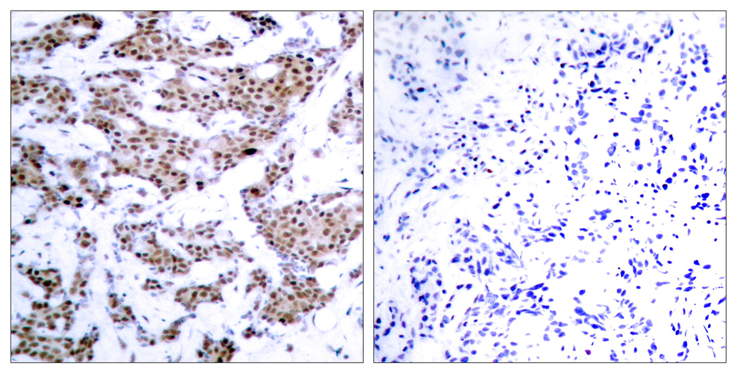 MEF-2 (phospho Thr312) Rabbit Polyclonal Antibody
