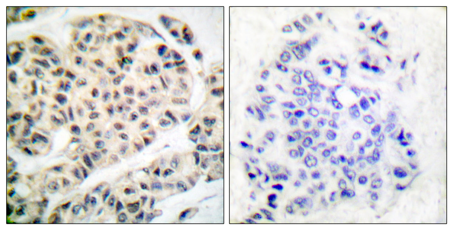 MEF-2 (phospho Thr319) Rabbit Polyclonal Antibody
