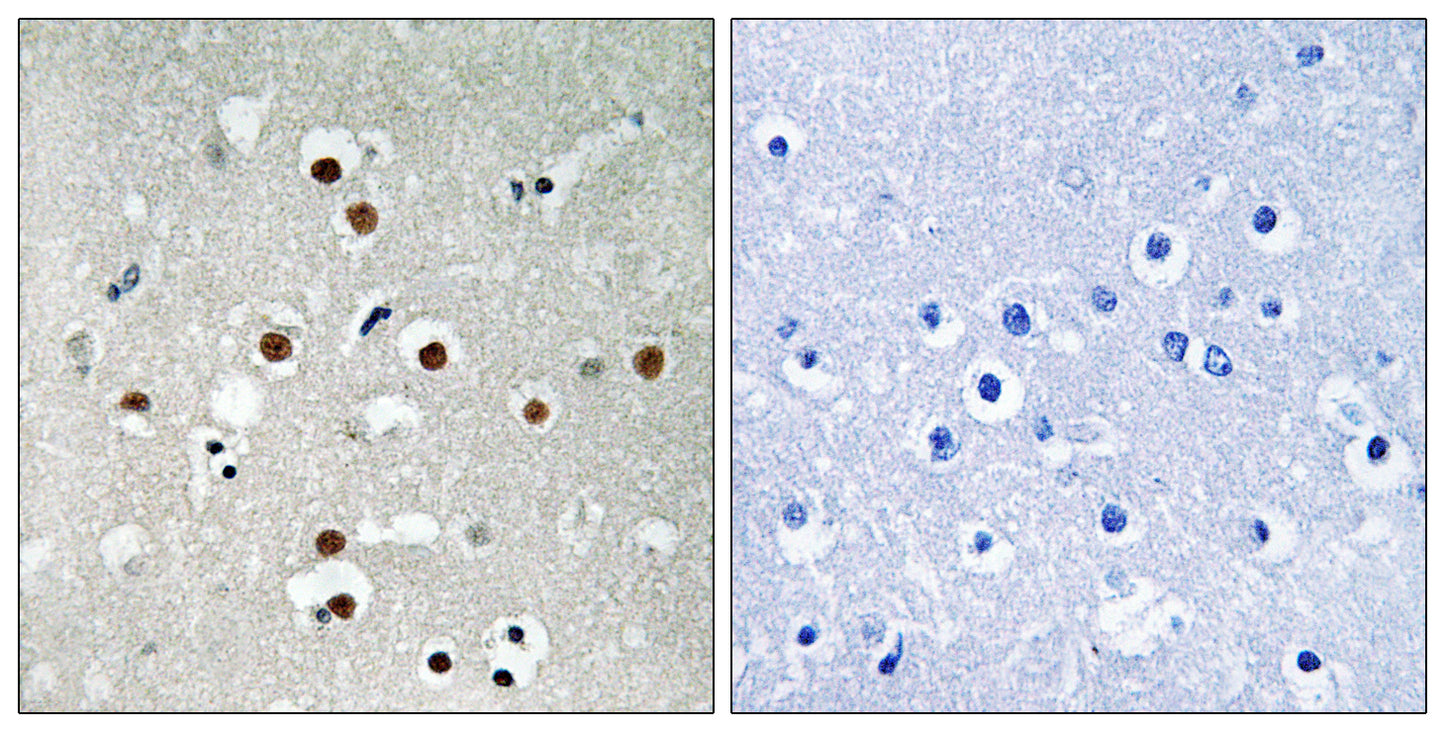 MEF-2C (phospho Ser396) Rabbit Polyclonal Antibody