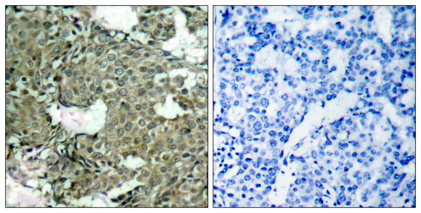 MEK-1/2 (phospho Ser222/226) Rabbit Polyclonal Antibody