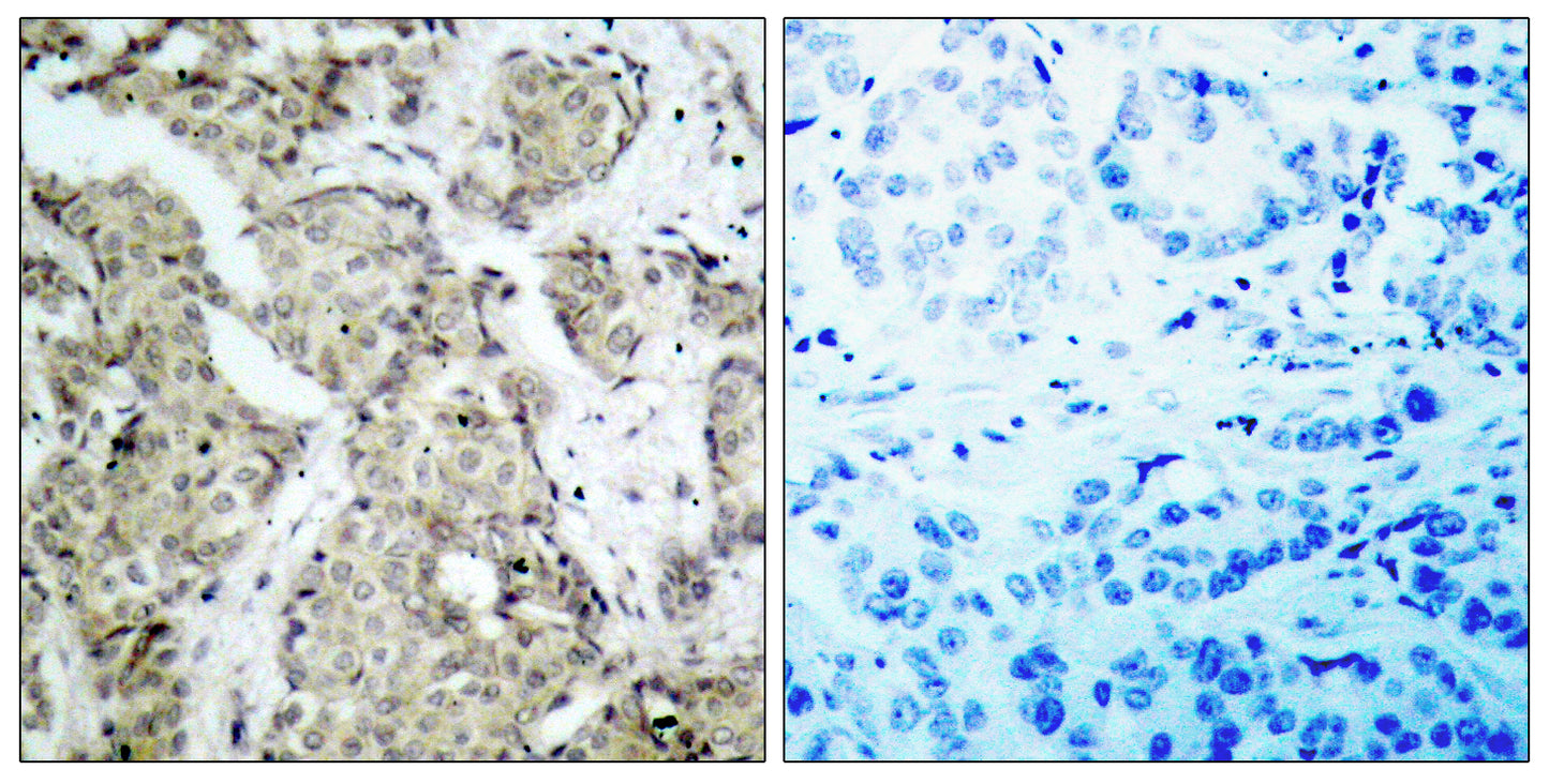 MEK-3 (phospho Ser218) Rabbit Polyclonal Antibody