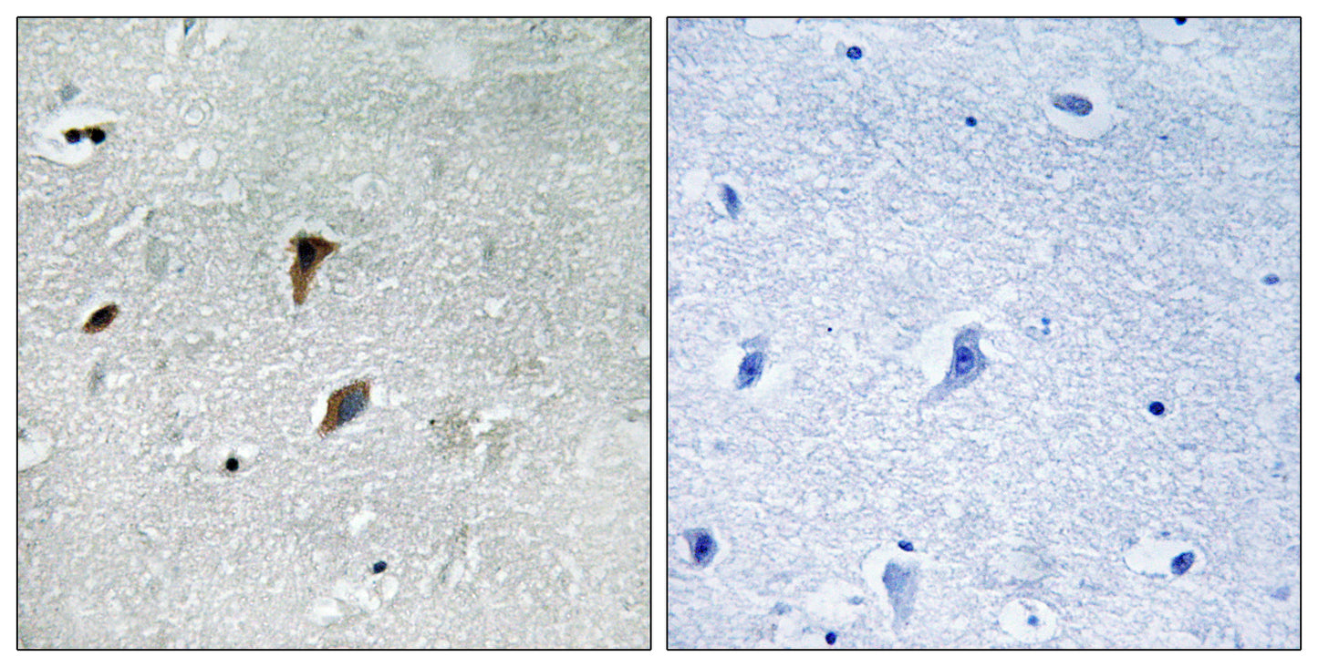 MEK-3 (phospho Thr222) Rabbit Polyclonal Antibody