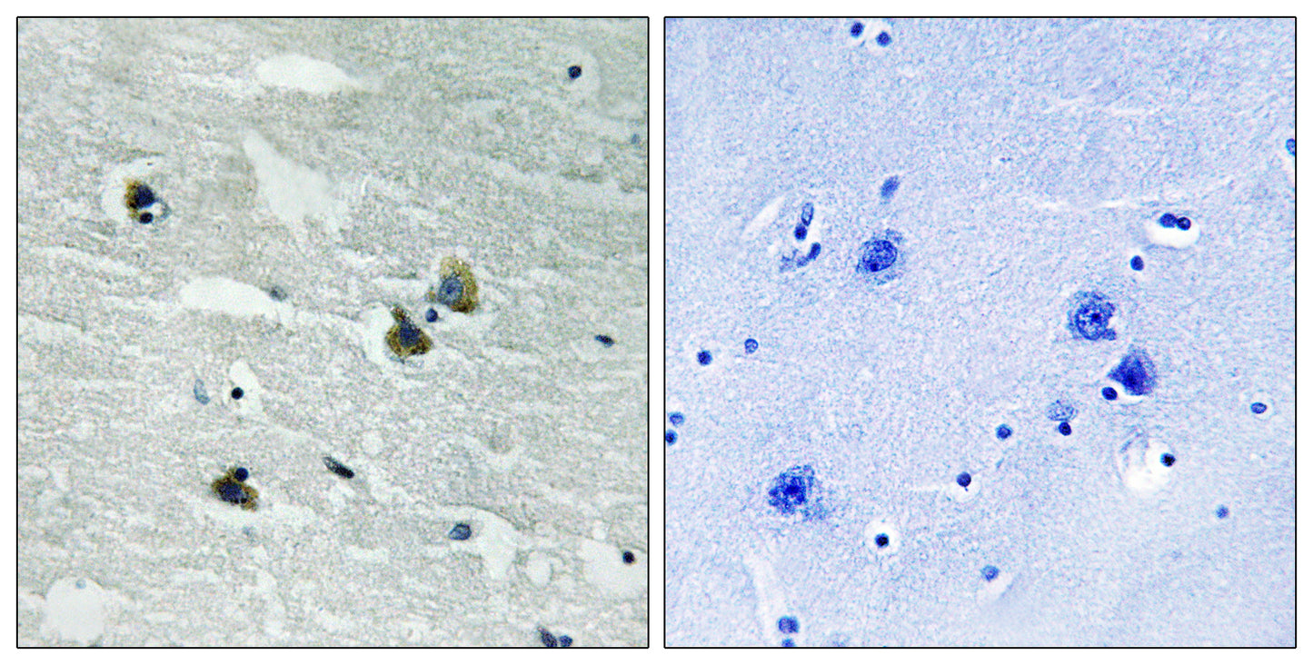 MerTK/Tyro3 (phospho Tyr749/681) Rabbit Polyclonal Antibody