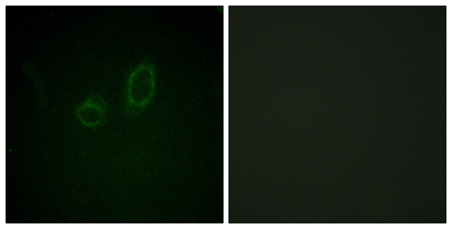Moesin/Ezrin/Radixin (phospho Thr558) Rabbit Polyclonal Antibody